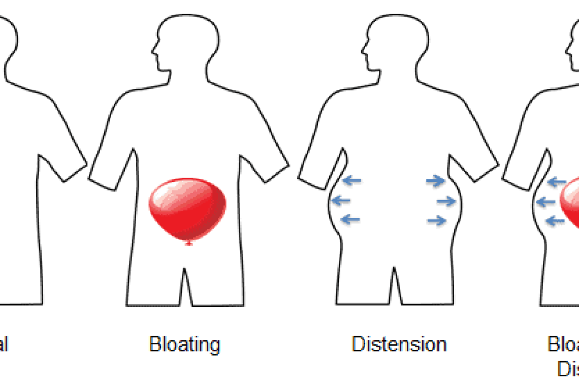 bloating_and_distension